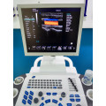 DW-C80 medical device 3 probes trolley color doppler ultrasound machine price